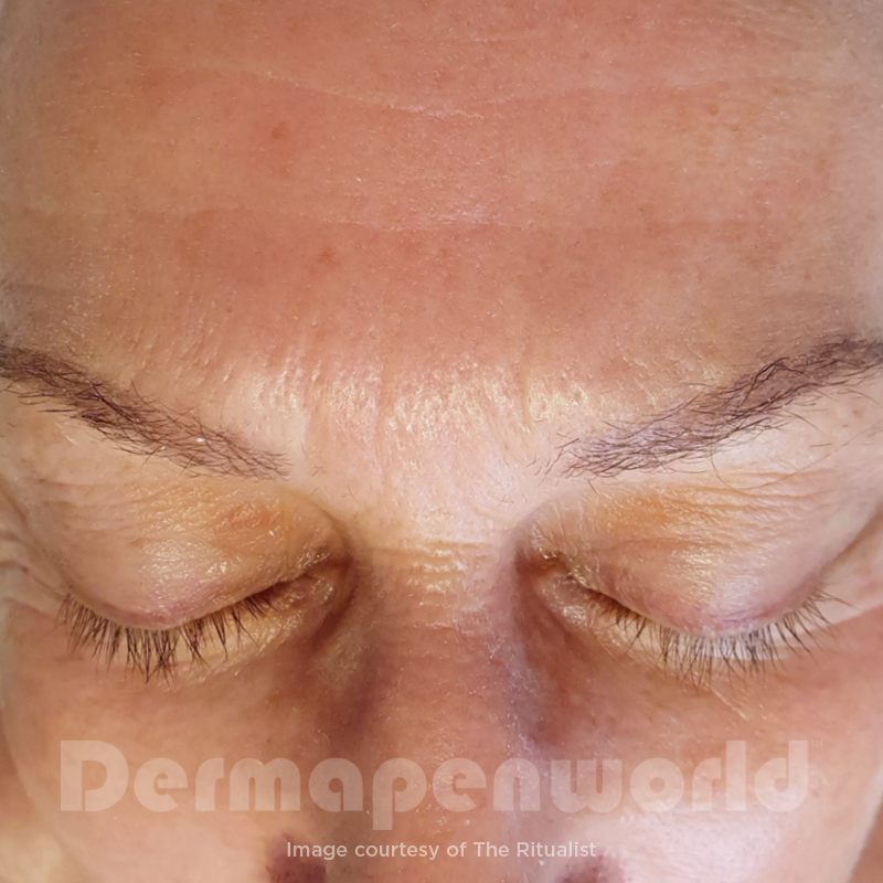 After image