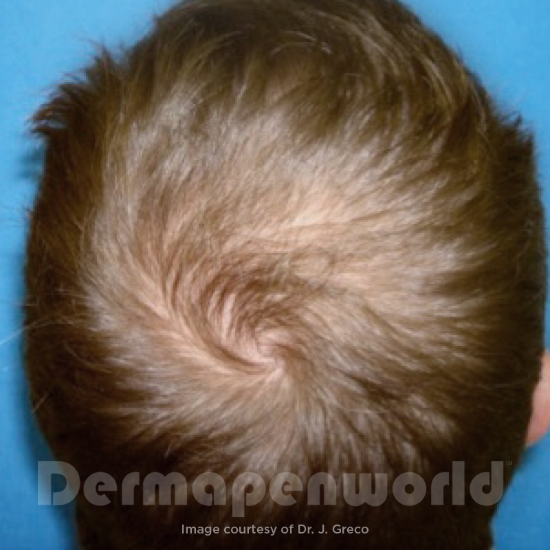 Before image