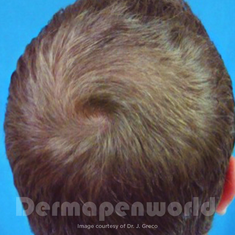 After image