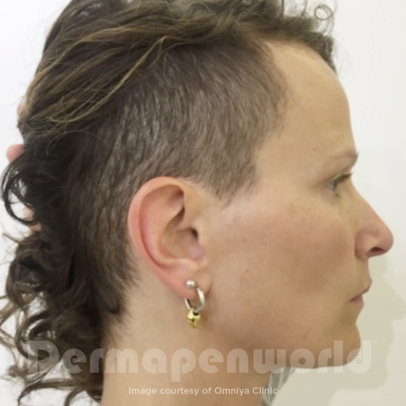 Before image