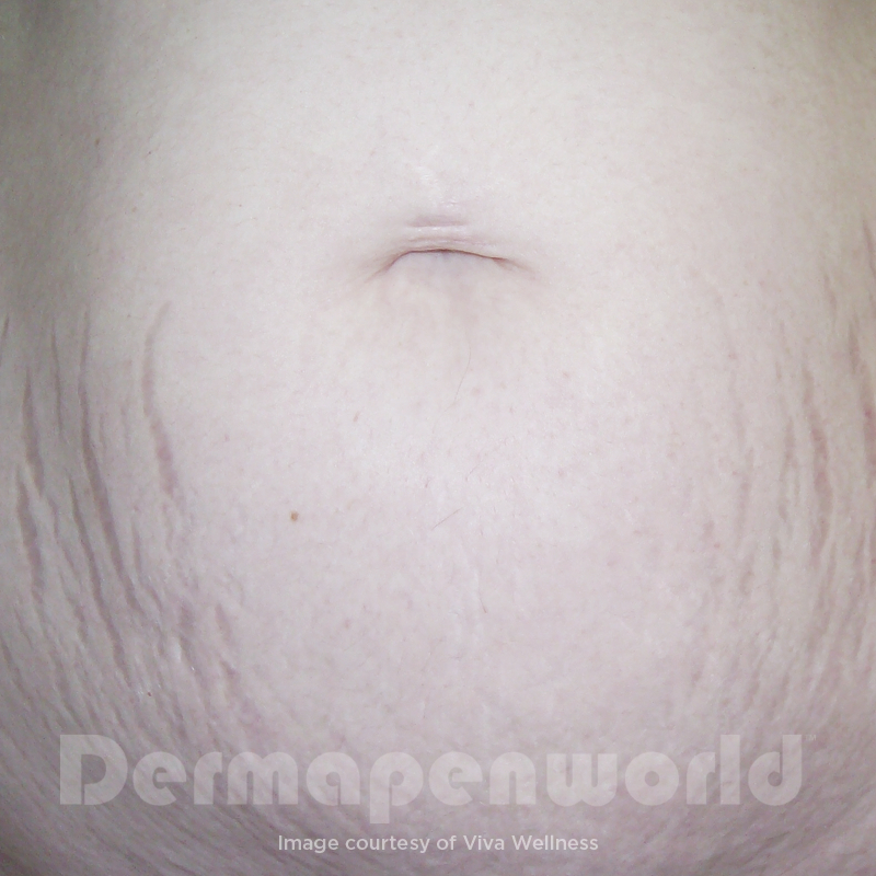 Before image