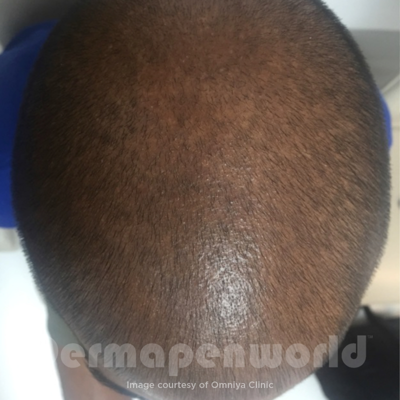 Before image