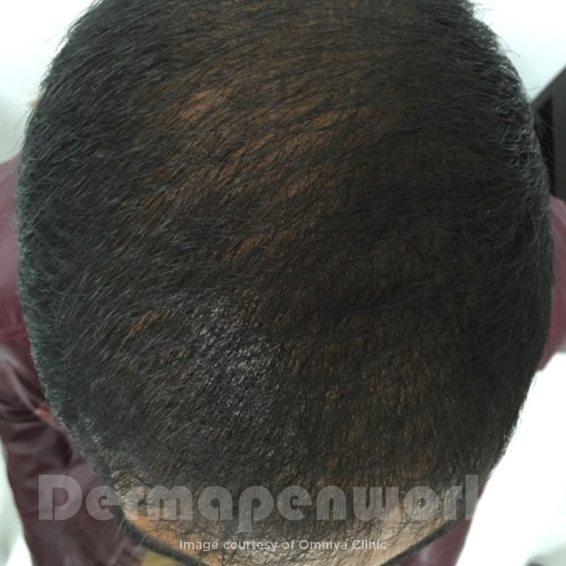 After image