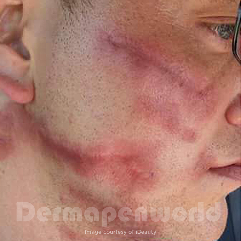 Before image